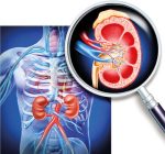 වාර්ෂිකව වකුගඩු මරණ 11000ක්