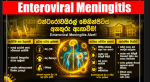 Meningitis රෝගී තත්වය පැතිරීම – පාලනය – වළක්වාගන්න උපදෙස් මාලාවක්